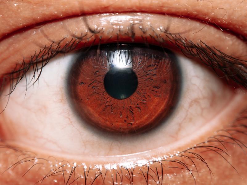 Ketahui 7 Jenis Penyakit Mata yang Umum Terjadi